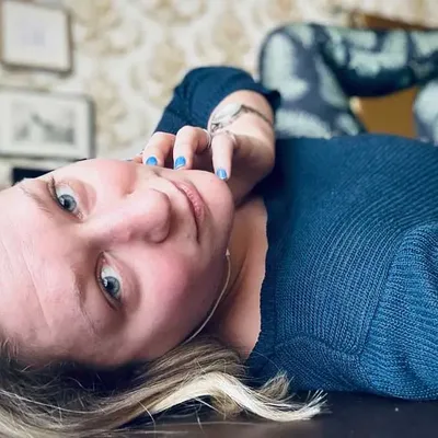 A Pro-Domme's bruises