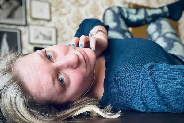 Blaue Flecken einer Pro-Domme